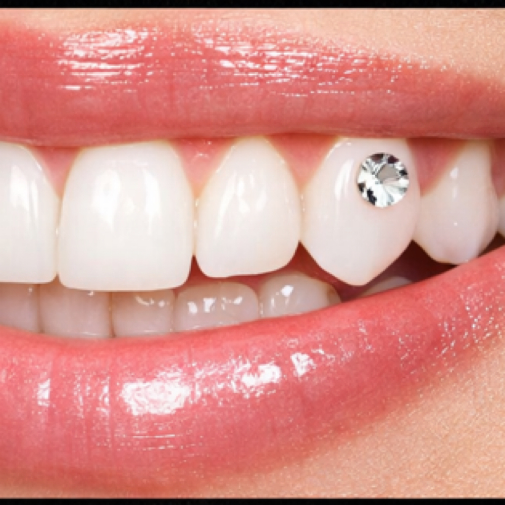 Teeth Gems at Luxury Beauti Studio in Chesapeake, VA