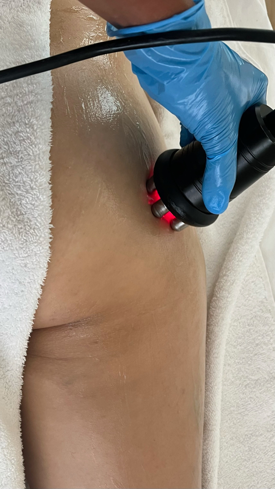 Skin Tightening & Cellulite