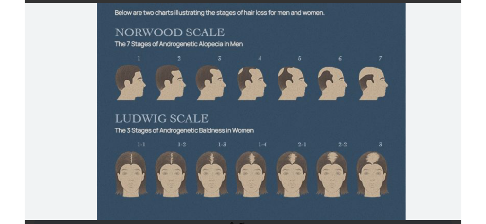 Hair Loss / Alopecia/ Scalp Txs