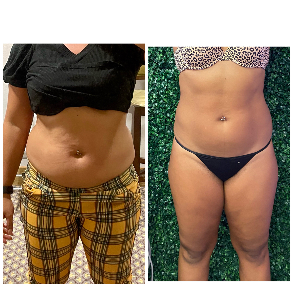 Divine Slim Package at Divinity Essence Spa in Winter Springs, FL