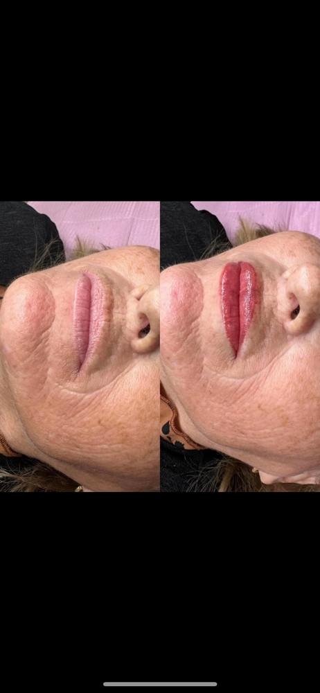 Lip Blushing