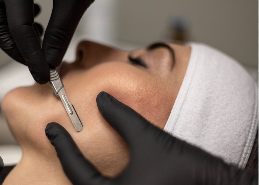 Dermaplane Facial