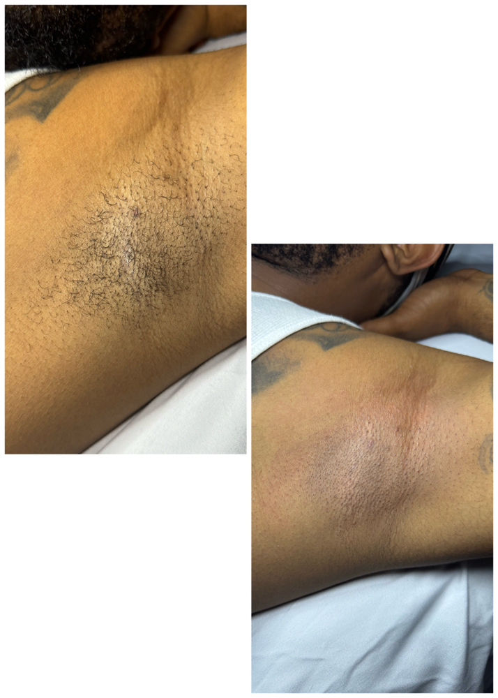 Underarm Wax