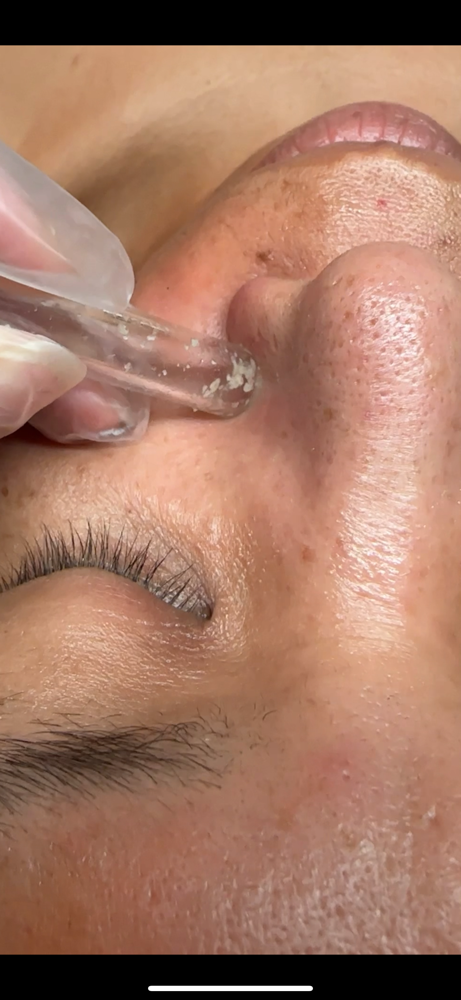 Vacuuming Facial