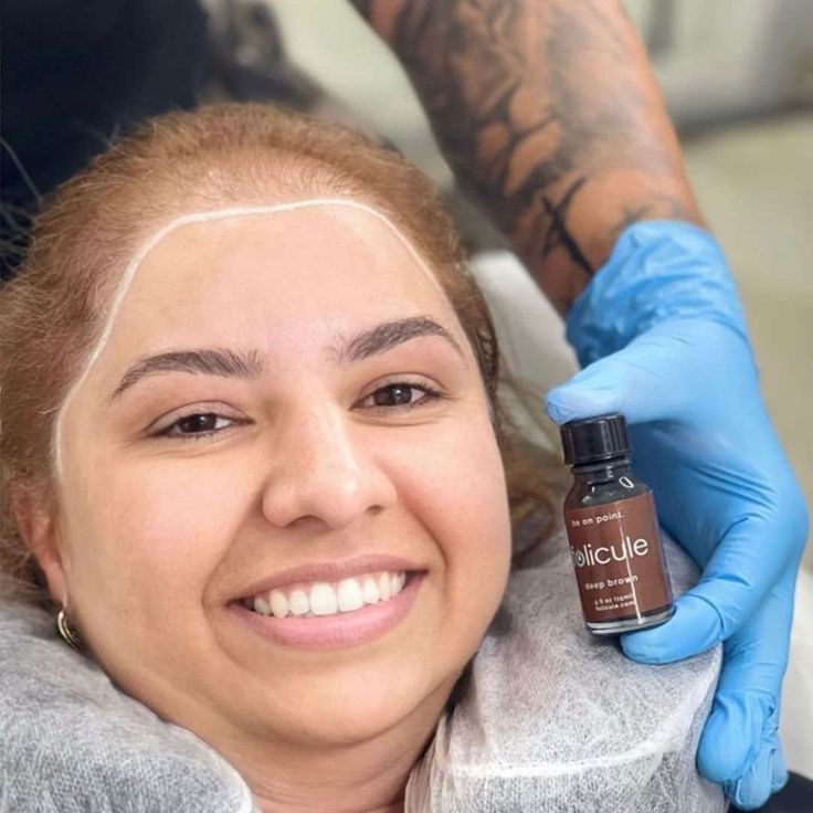 Scalp Pigmentation