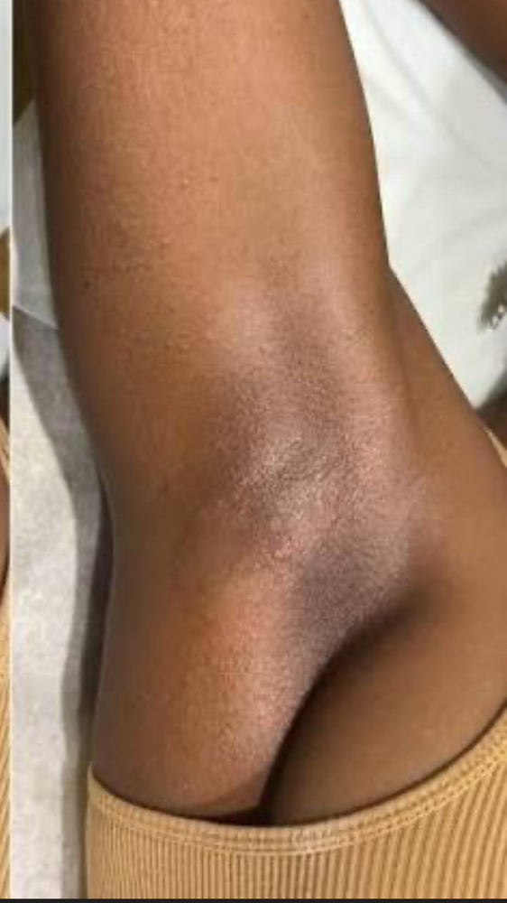 Underarm at The Wax Room in Midlothian, VA