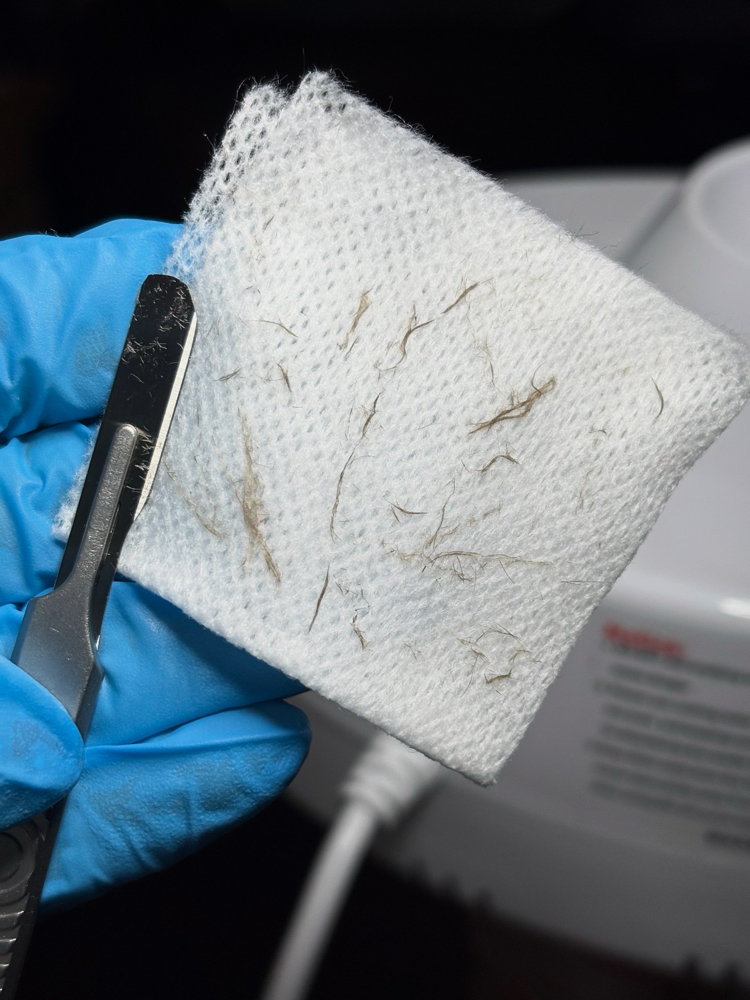 Dermaplane at Nails by Janessa in Moreno Valley, CA