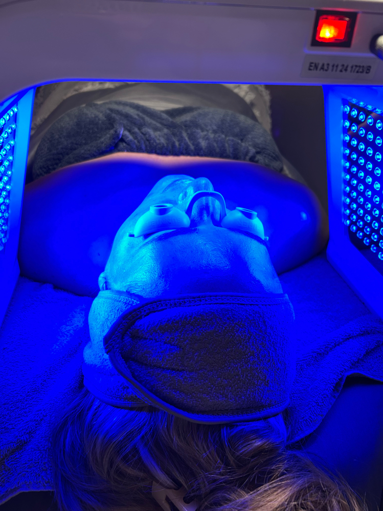 Acne Facial