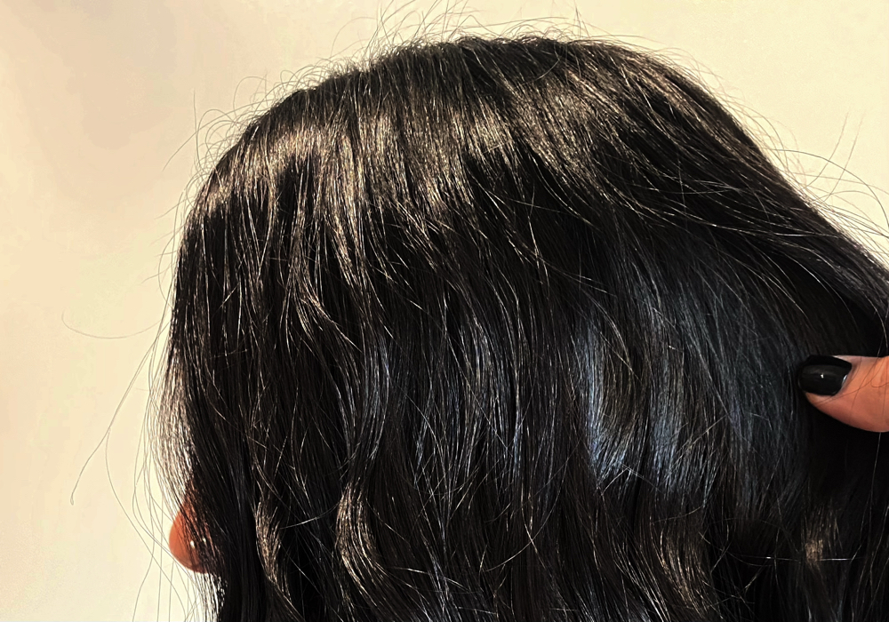 Root Retouch