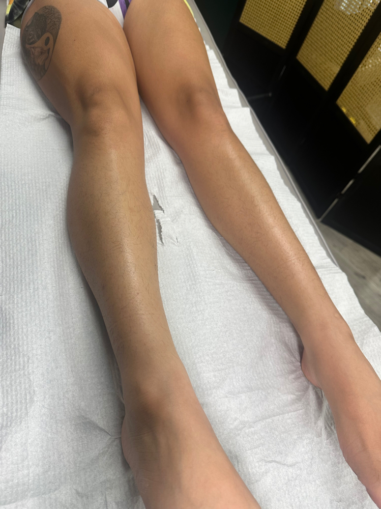Full Leg