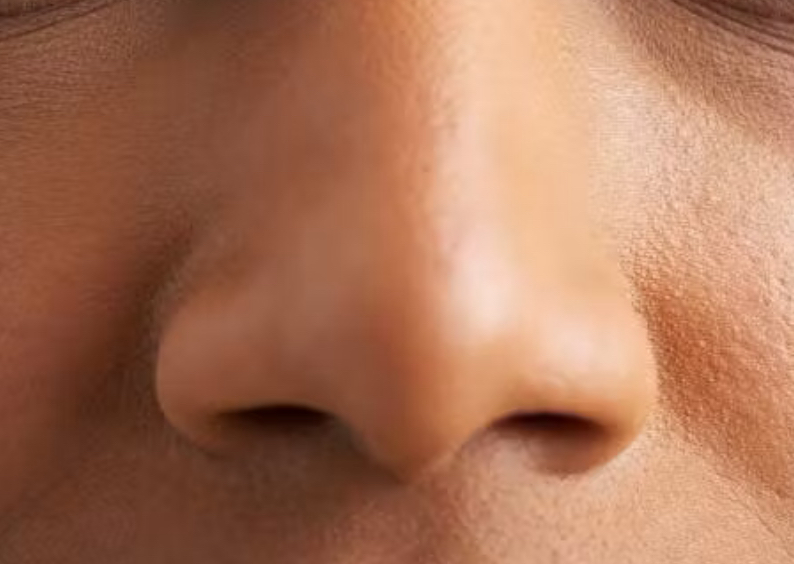 Nose