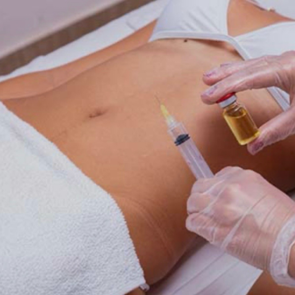 Coctel Reductor IM at Dream Body Esthetic in Orlando, FL