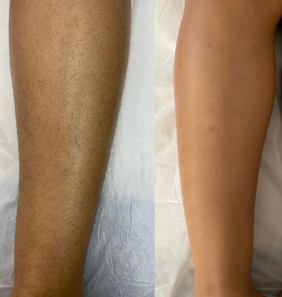 Leg at Blooming Beauties Co. in Huntsville, AL