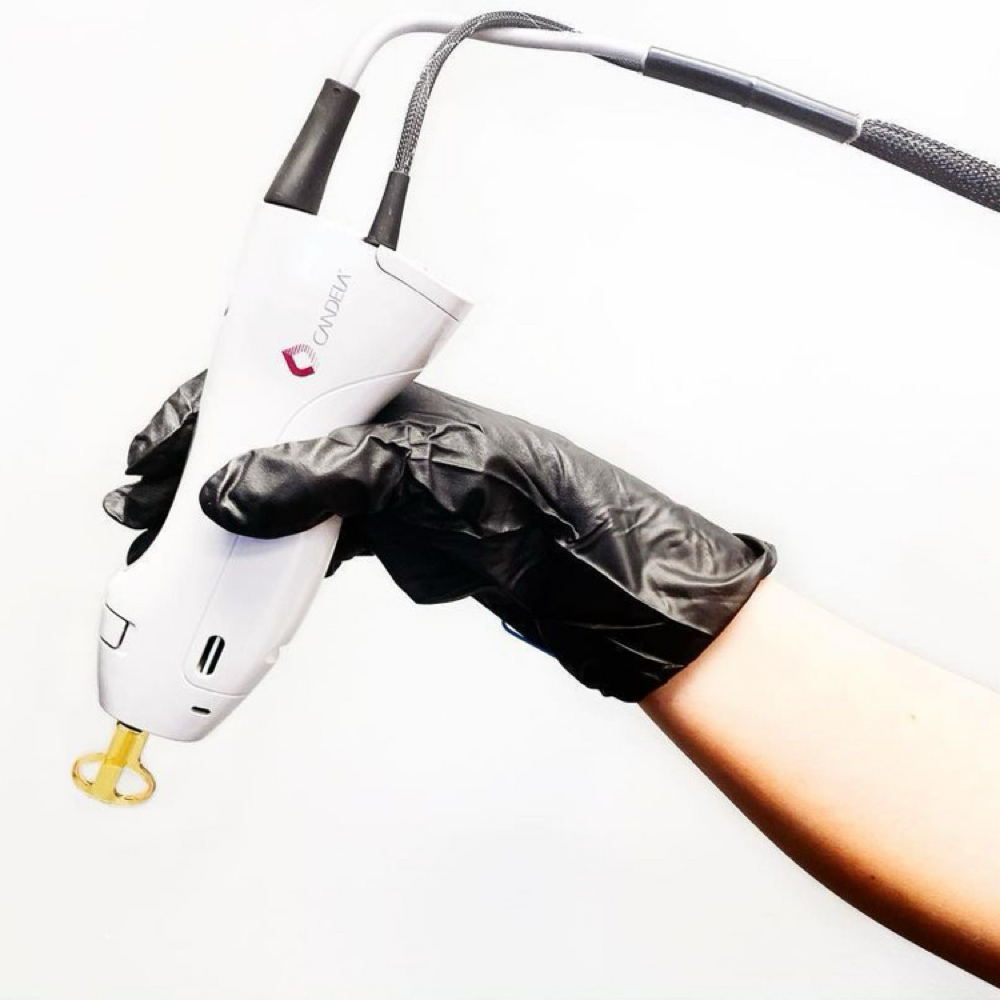 YAG SKIN TIGHTENING/GLOW FACIAL at BEAM LASER STUDIO in Plymouth, MI
