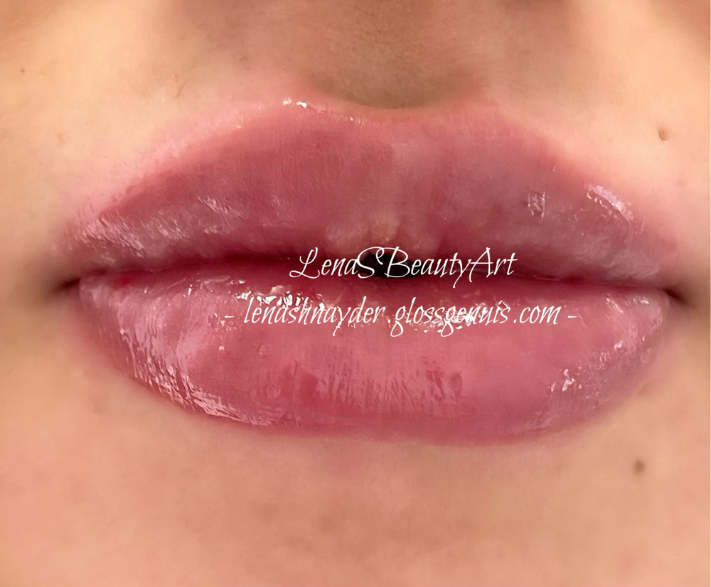 Hyaluron Pen Infusions Touch Up