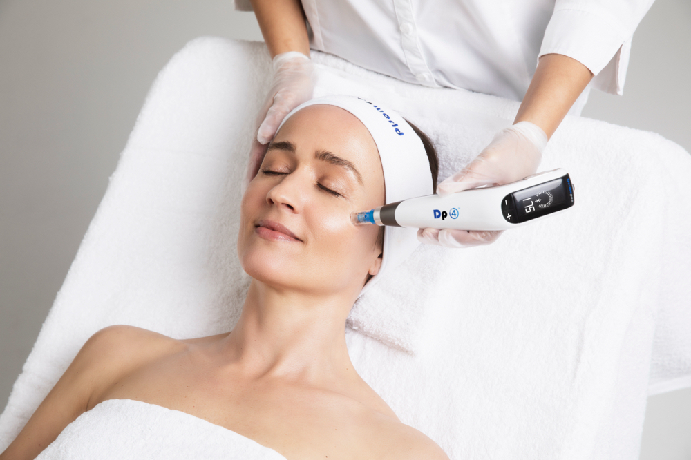 Microneedling