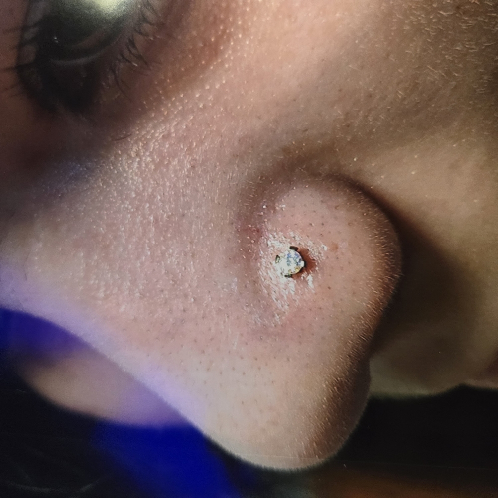 Nostril (Side Of Nose)