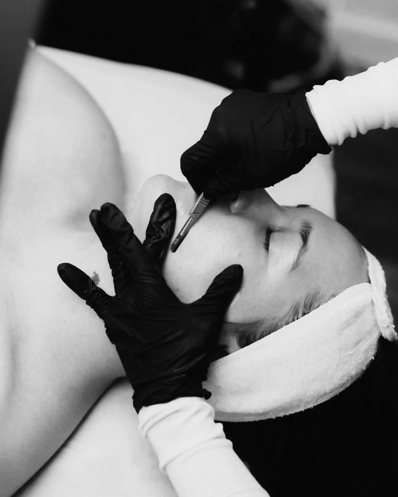 DERMAPLANING ADD ON