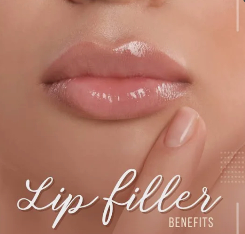 Lip Filler )💉✨ at Elite Luxe  MedSpa and Cosmetics in Houston, TX