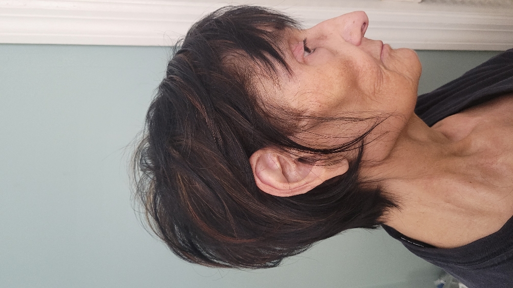 Root Retouch
