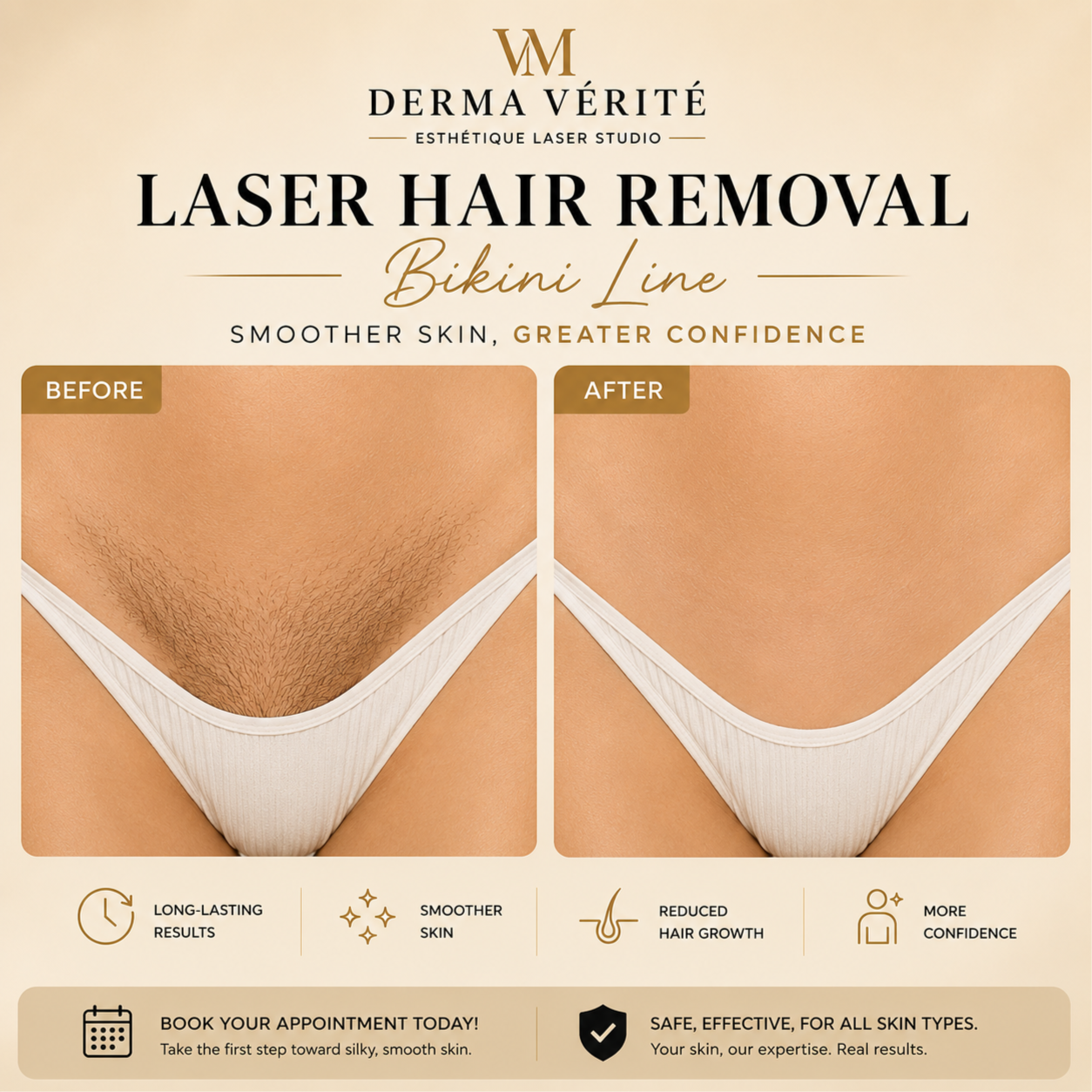 Bikini Line Laser Hair Removal at Derma Verite Esthetique Laser Studio in Elmhurst, NY