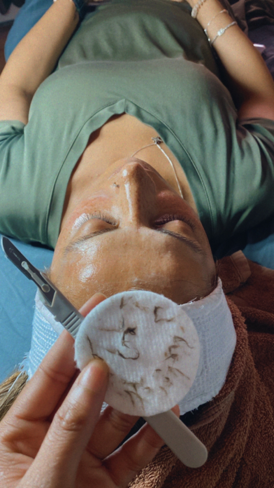 Dermaplane Facial