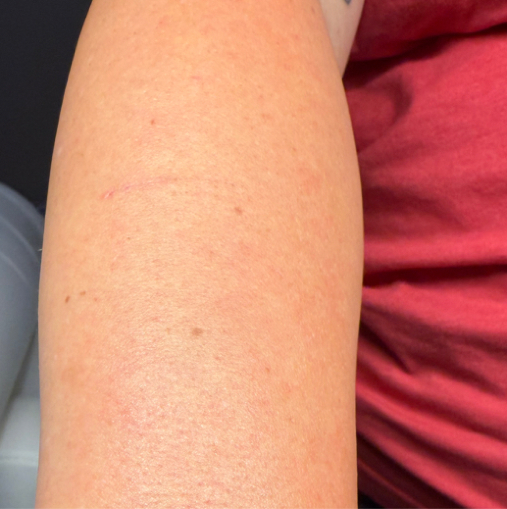 Full Arm Wax at Illuminate Dentistry & Aesthetics in St. Joseph, MO