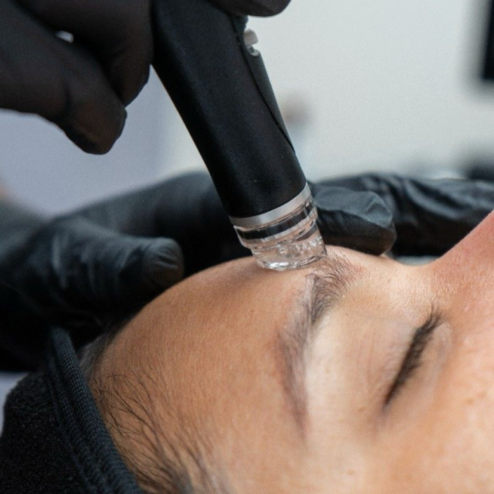 HydroFacial at Glowing Skin Studio in Leavenworth, KS