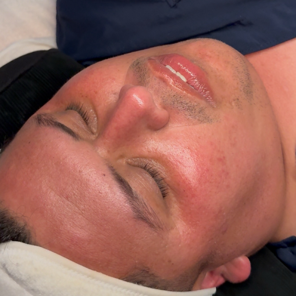 Gentlemans Facial at Nikki Lee Esthetics in Pearland, TX