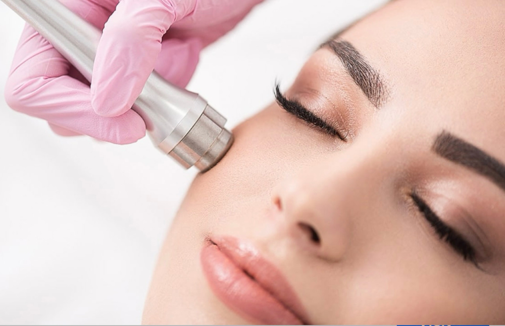 Microdermabrasion