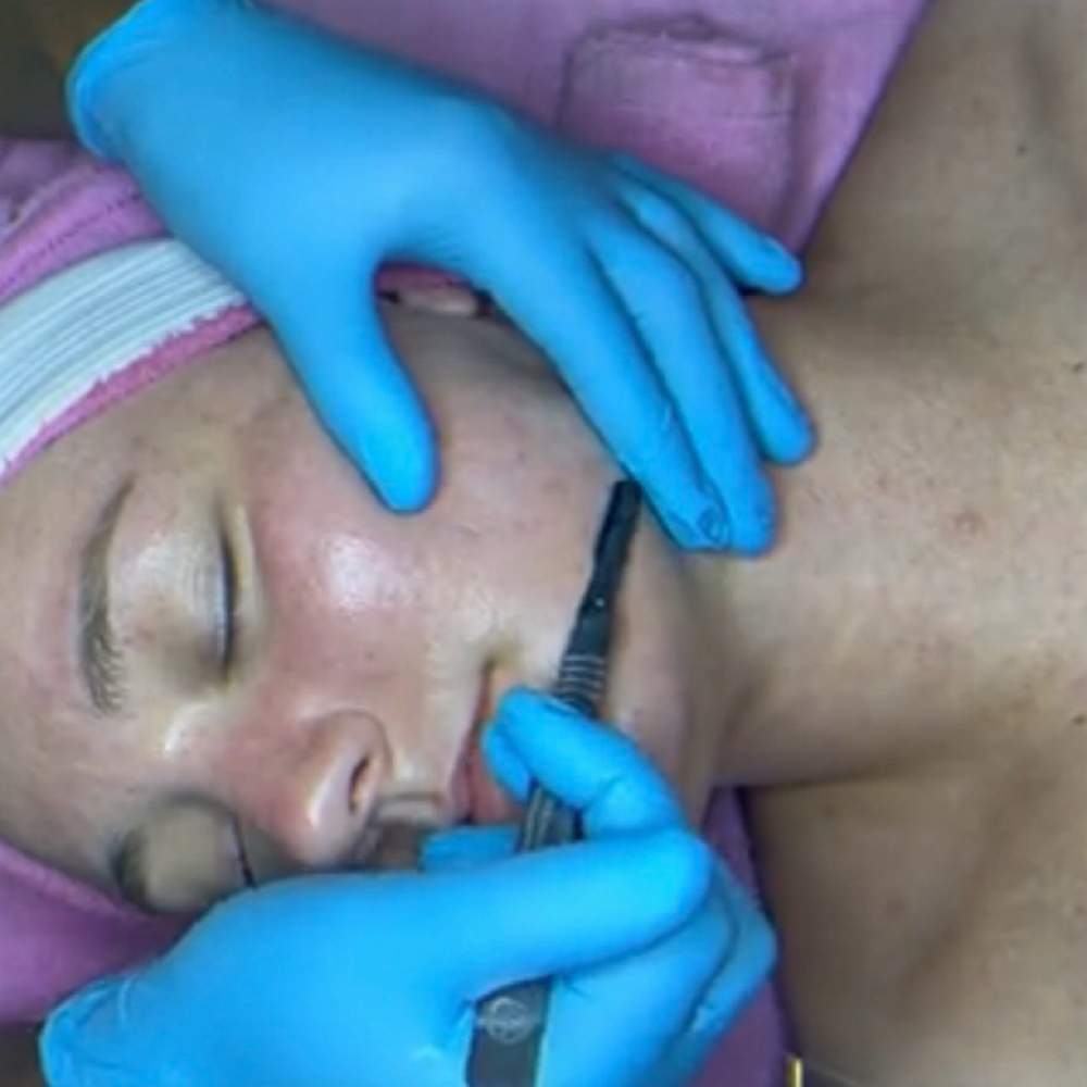 Dermaplane at Esthetic by She's Bea-U-tique in Tulsa, OK