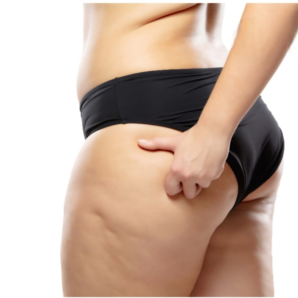 Glutes & Thighs Cellulite Reduction at Lovinme Smoother Silhouette in Murrieta, CA