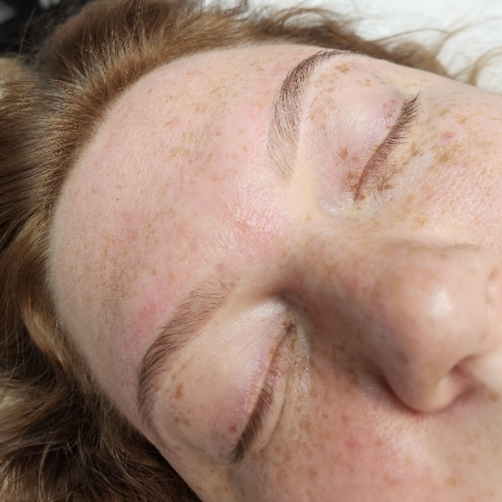 The Soft Definition at Skin Quality Esthetics in Harrisburg, NC