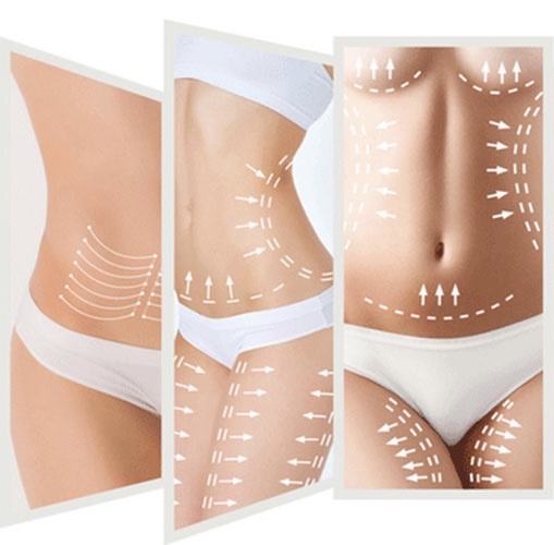 Full Body Deluxe at Divine Sculpting in Arvada, CO