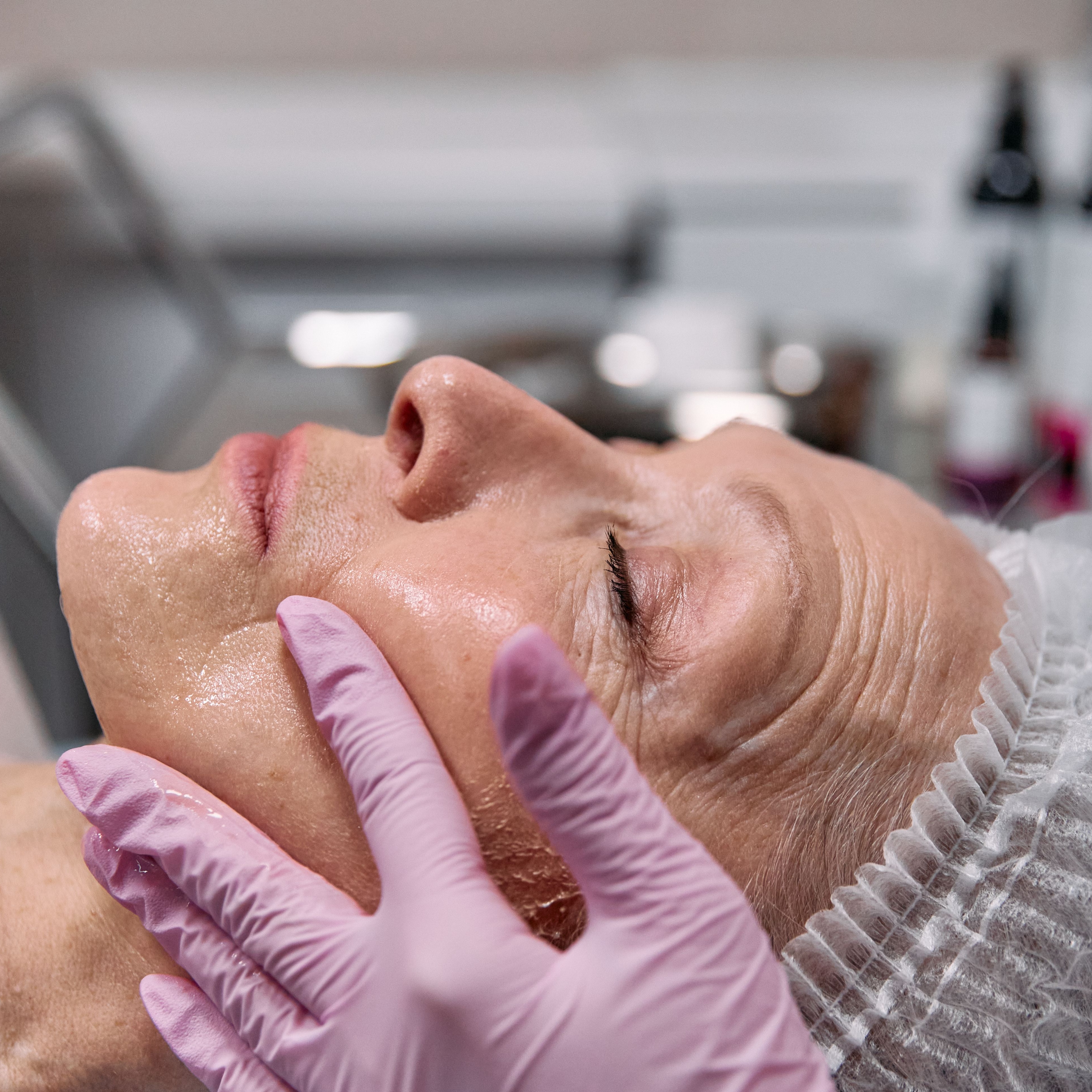 Express AdvancedRenewal Peel at SkinFix Pro in Longwood, FL