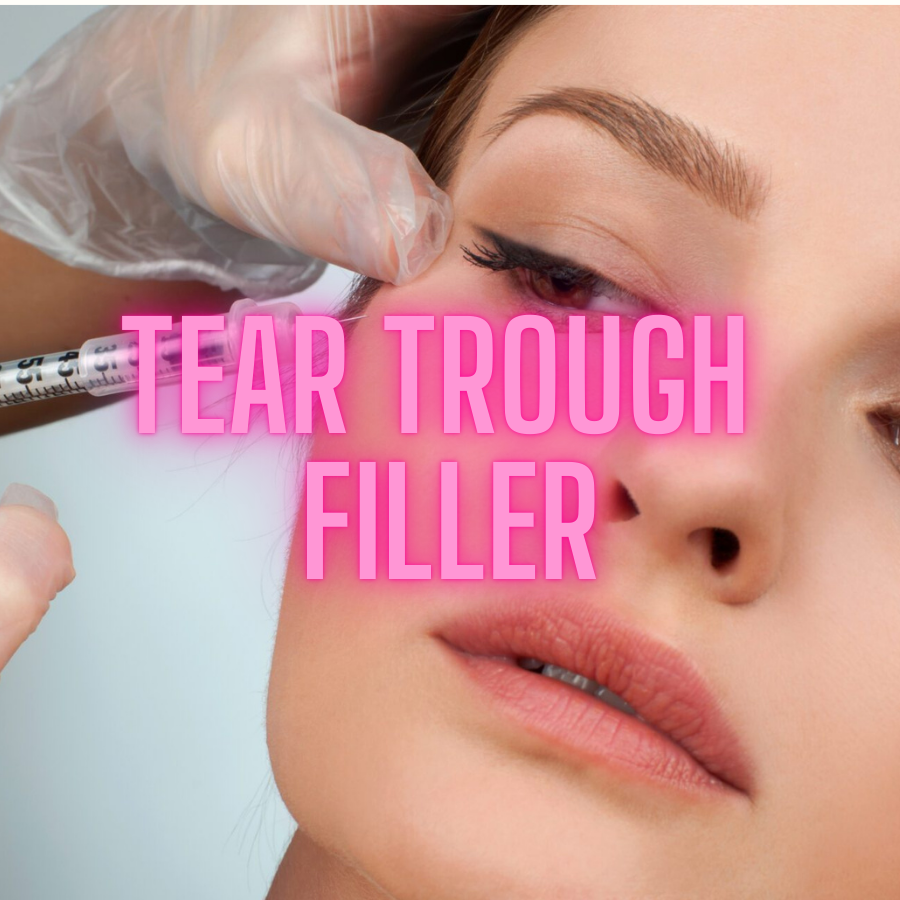 Tear Trough Filler