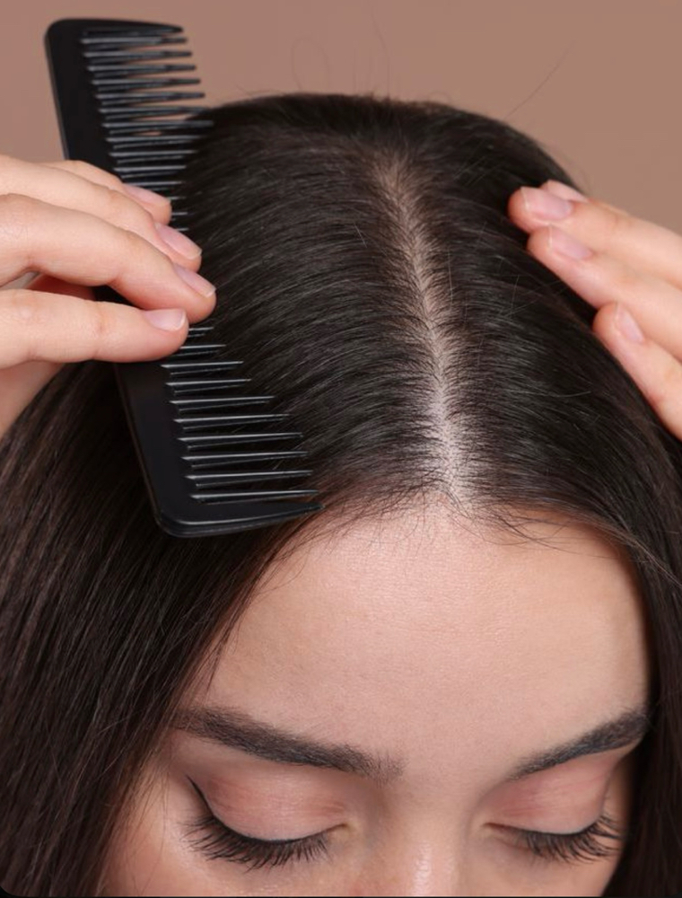 Scalp Treatment