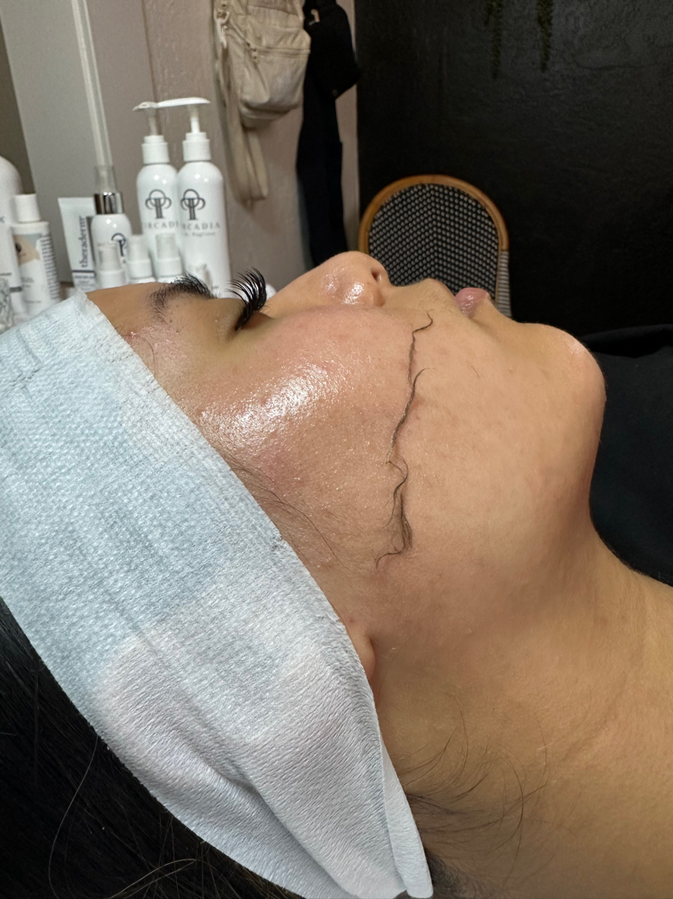 Dermaplane Facial