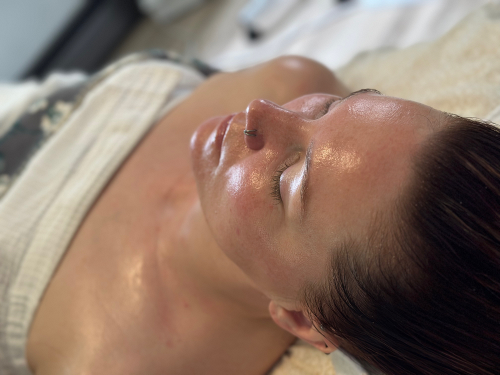 Customized Peels (no Downtime)