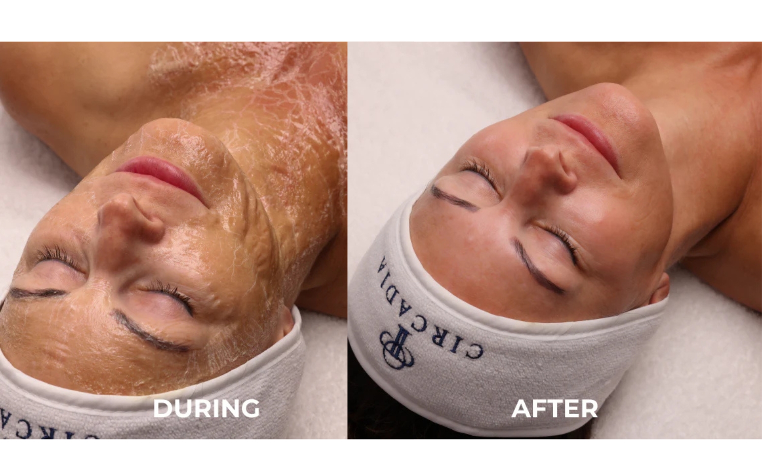 Luxe Lift Anti-Aging Facial