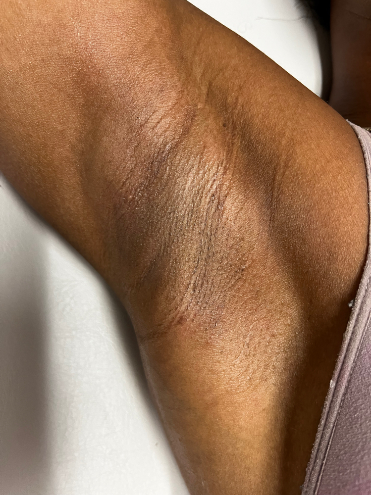 Underarm + Brazilian wax
