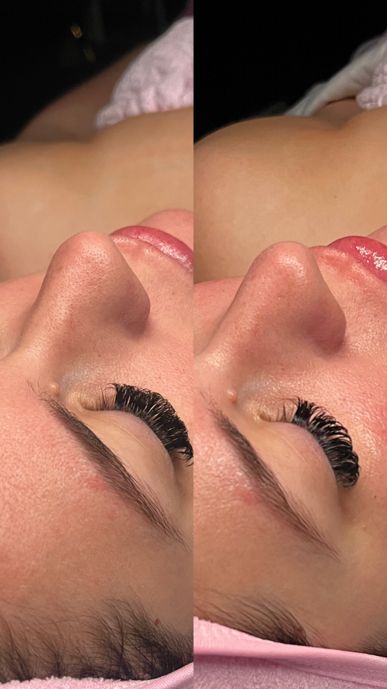 HydroDiamond Facial