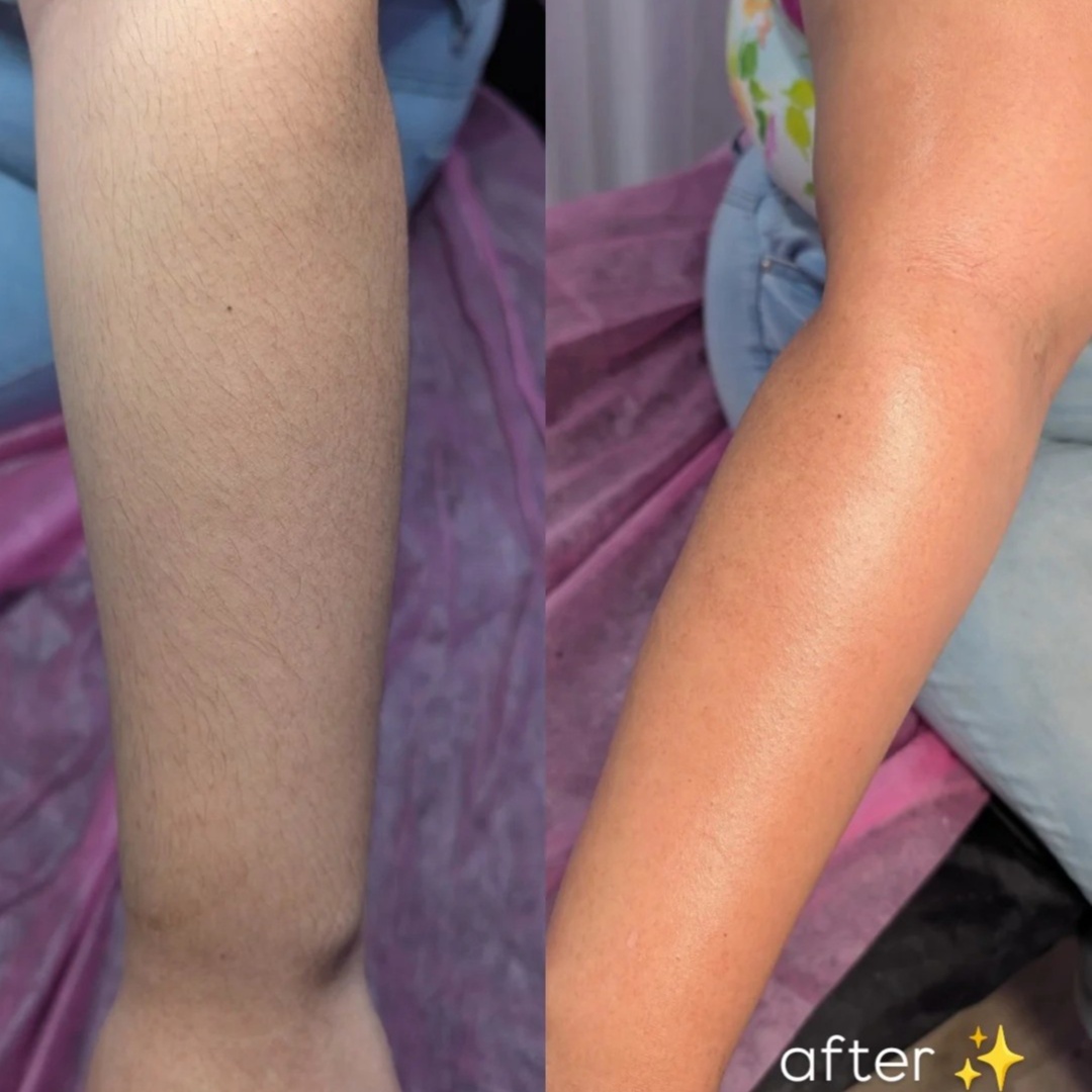Full Arm Wax at Skin by Kay in Orange, CA