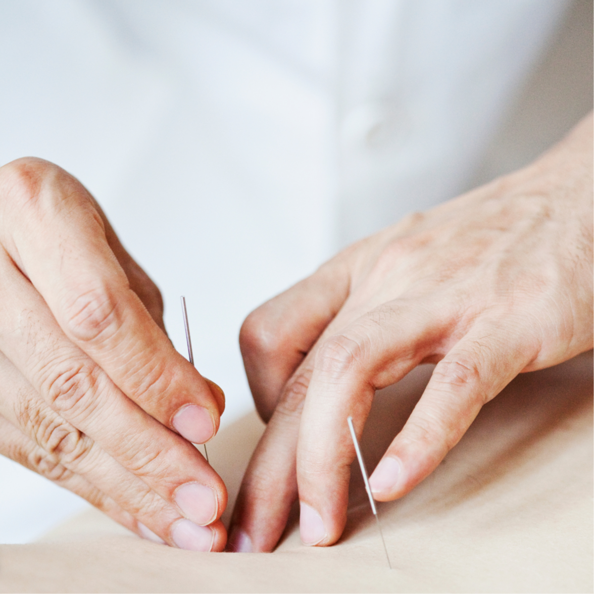 Traditional Acupuncture at The Rose and Yarrow, LLC in Louisa, VA