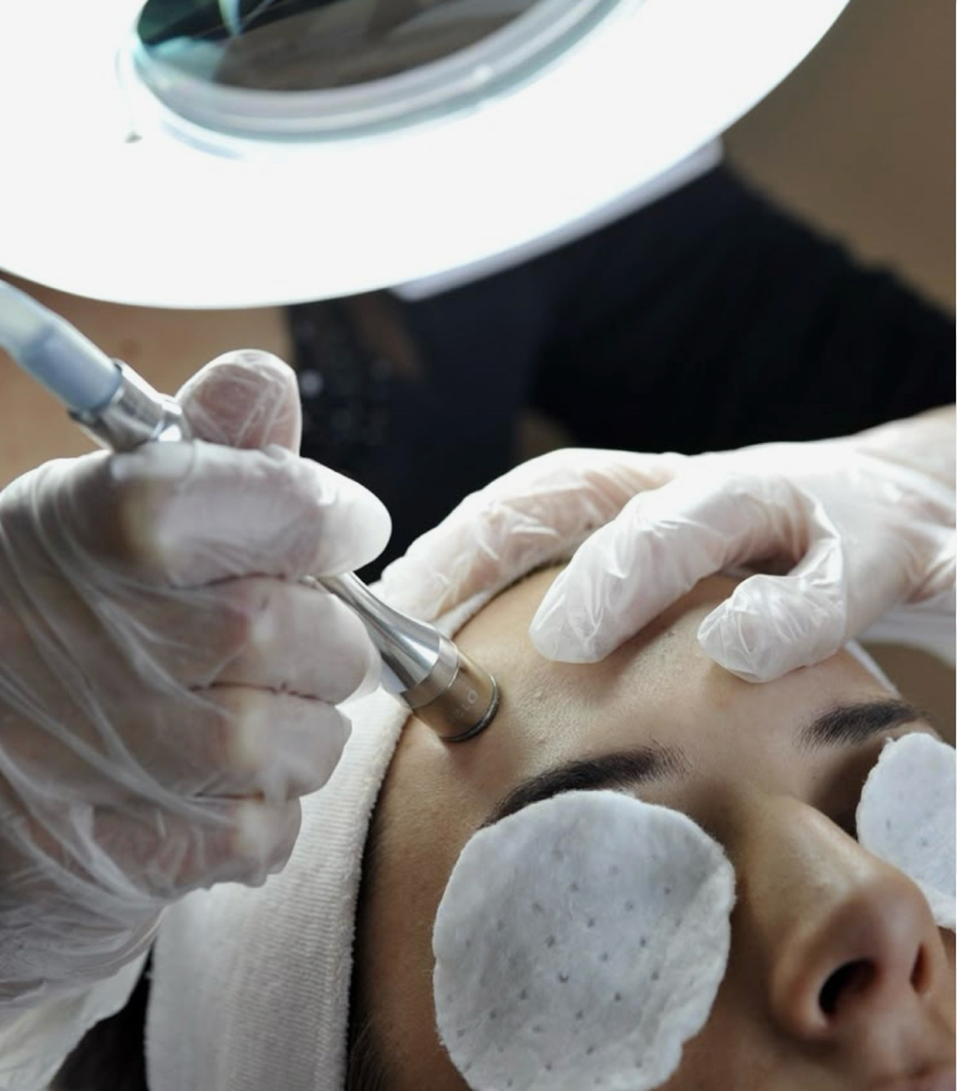 Microdermabrasion Facial at Haus of Esthetix in El Paso, TX