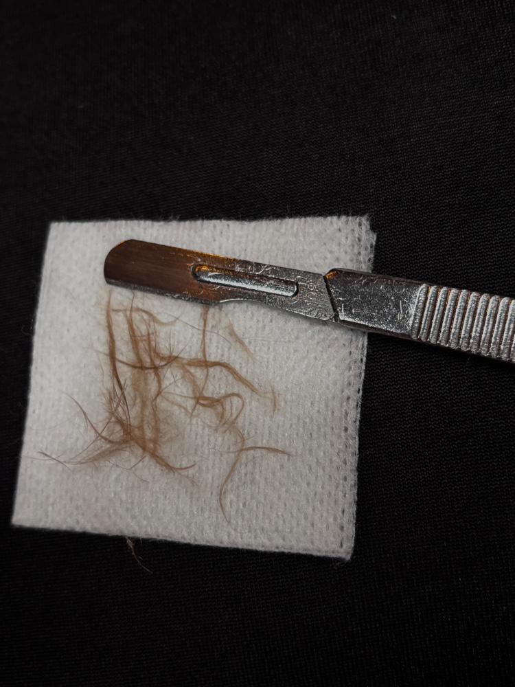 Dermaplaning And Microneedling