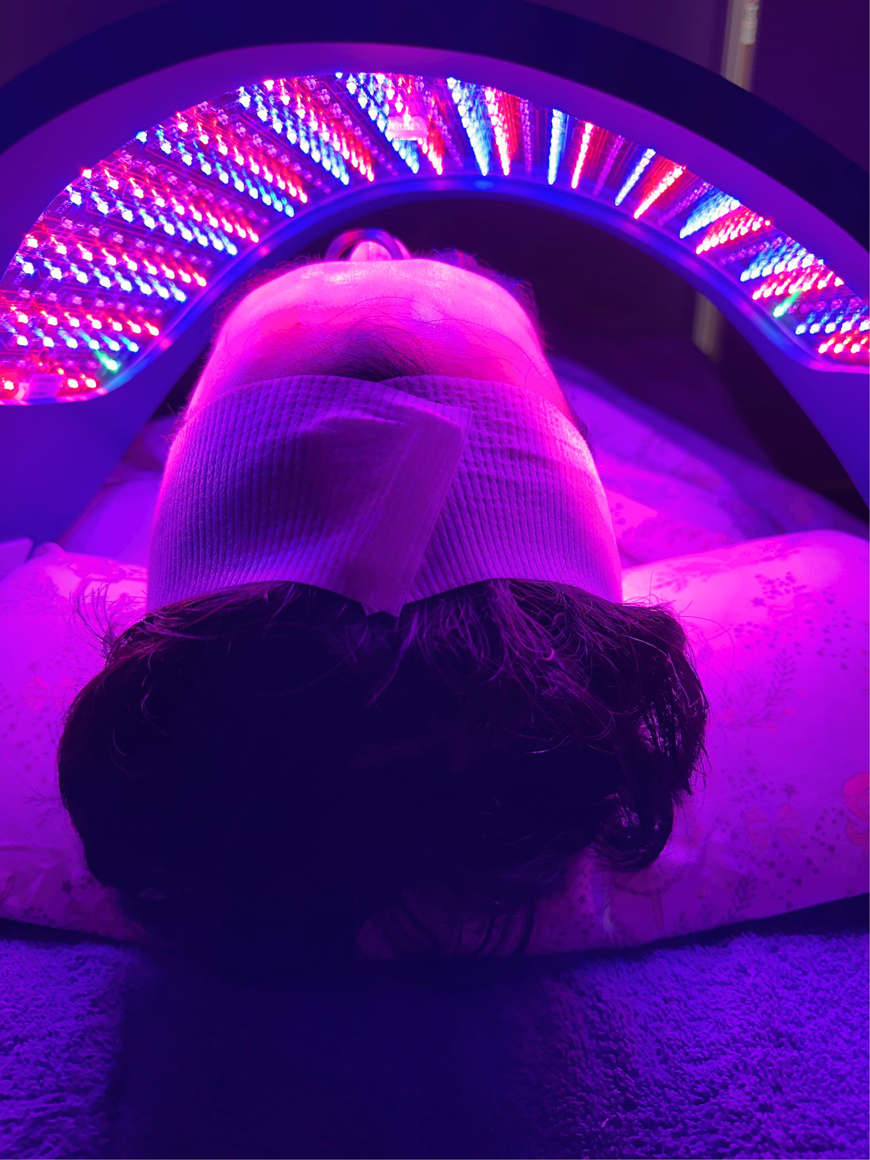 Celluma Light therapy