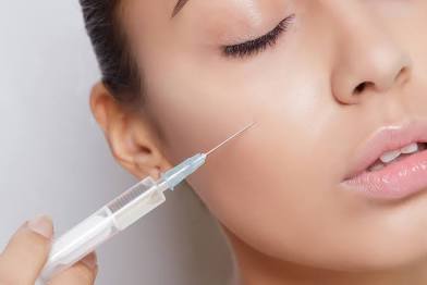 Dermal Fillers