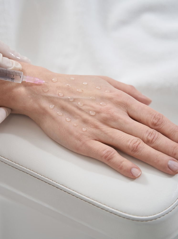 Hand Rejuvenation
