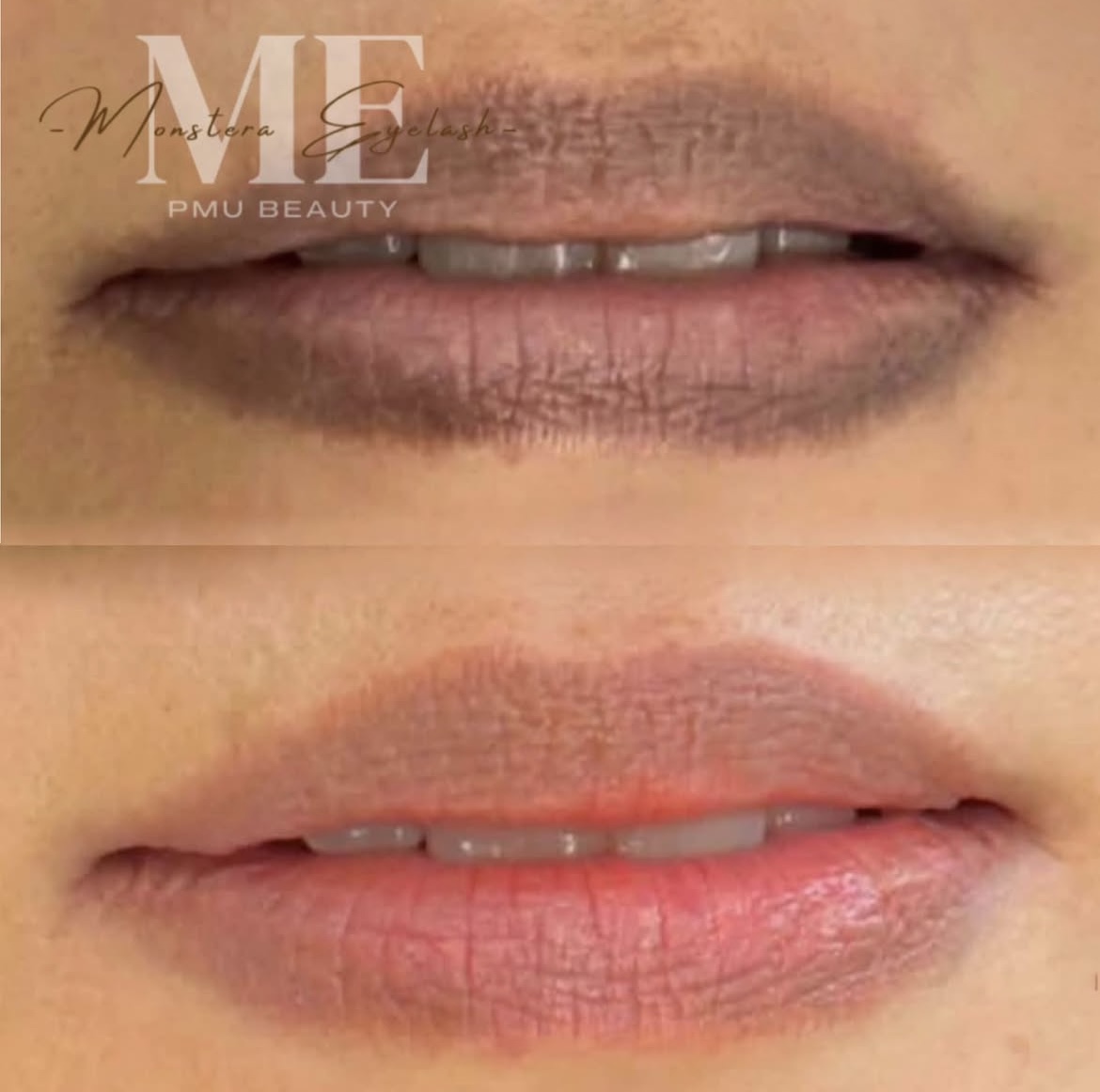 Dark Lip Touch-Up 4-6 Week